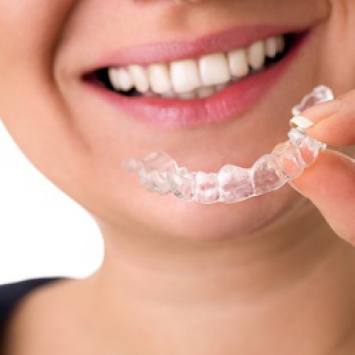 Picture of clear braces