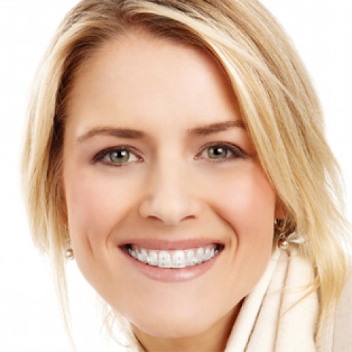 Picture of a smiling white woman wearing braces